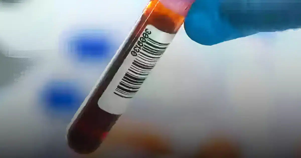 Les scientifiques révèlent le groupe sanguin qui présente le risque le plus faible de maladie cardiaque