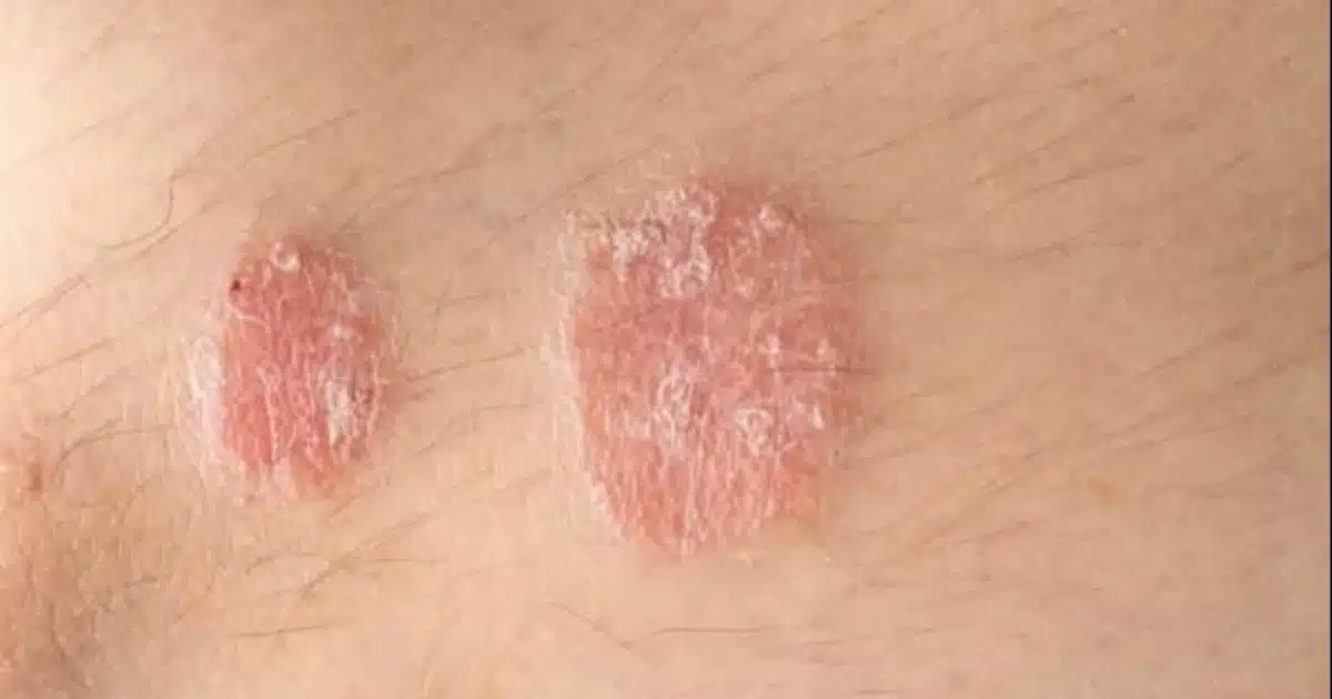 Les signes d’alerte sur votre peau à ne jamais ignorer