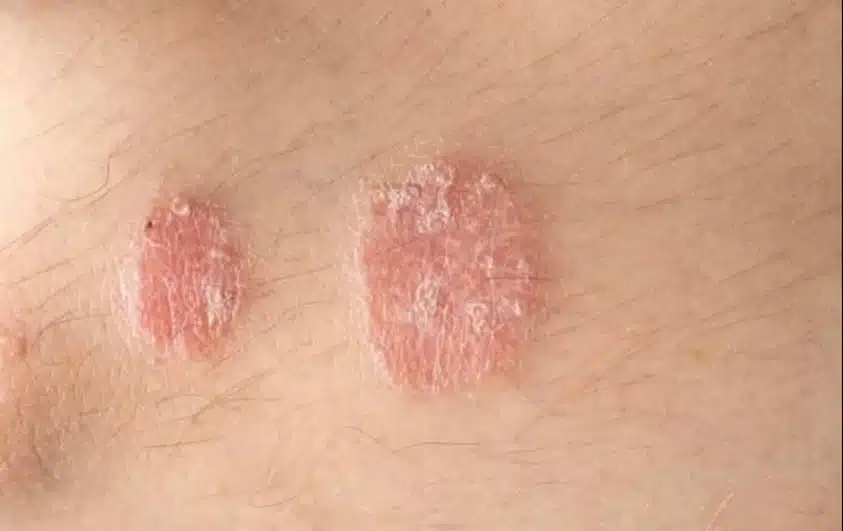 Les signes d’alerte sur votre peau à ne jamais ignorer