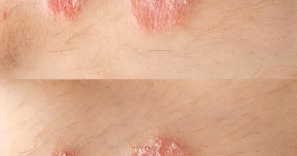 Les signes d'avertissement que vous ne devriez jamais ignorer sur votre peau