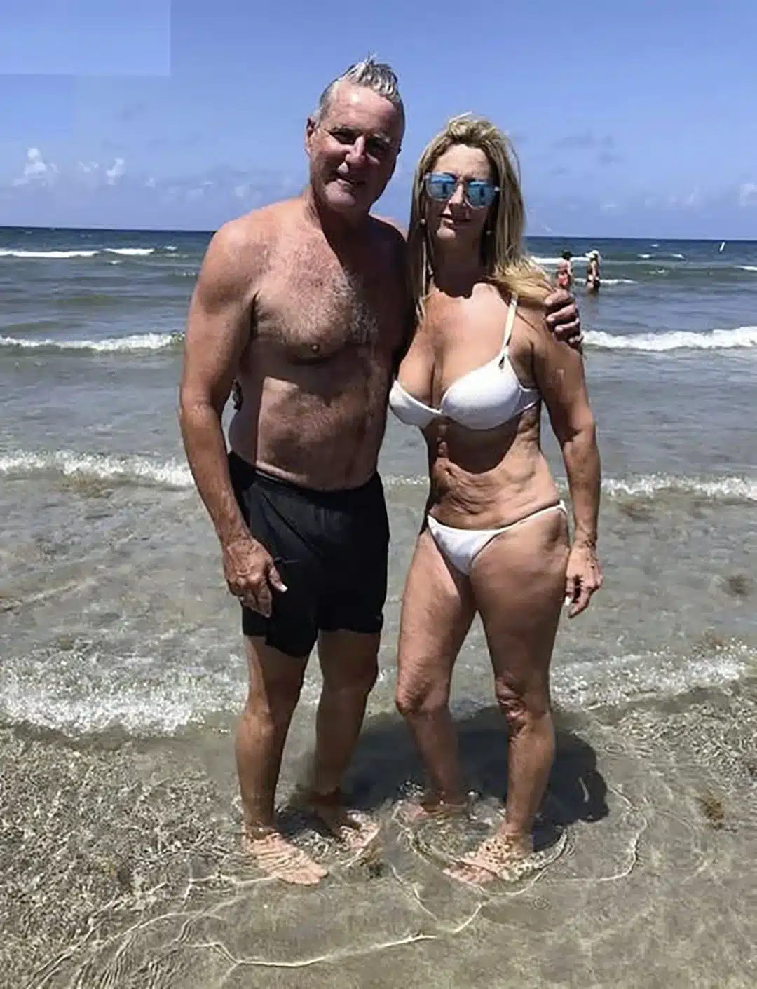 Ma belle-soeur m’a humilié après avoir posté une photo de mon « corps ridé » en maillot de bain
