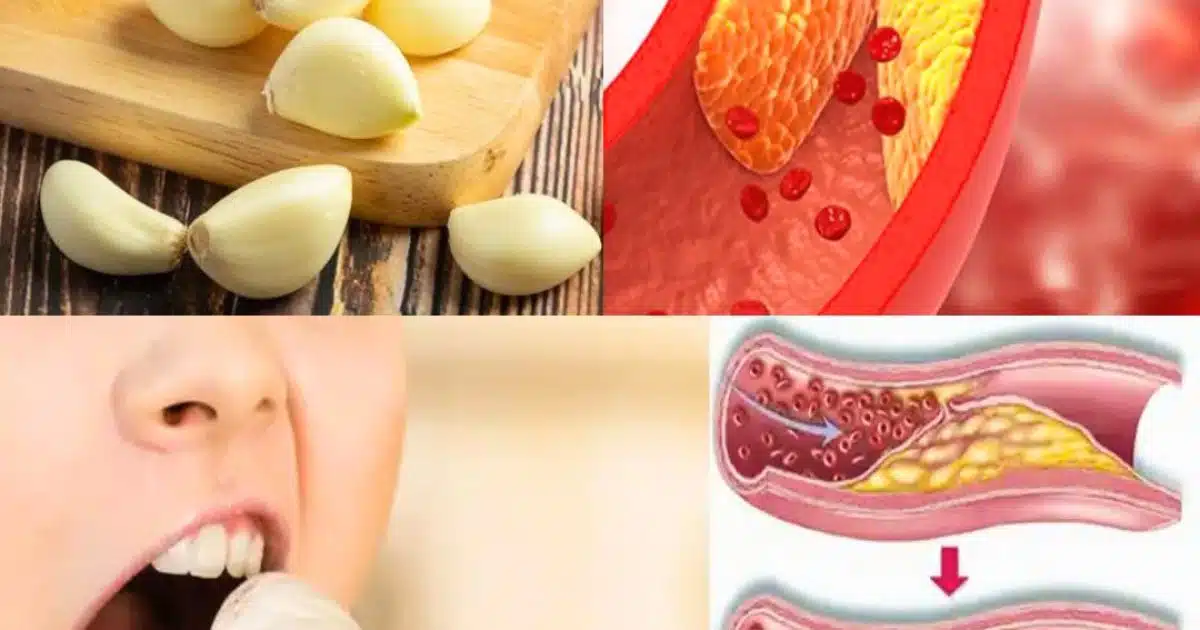 Manger de l'ail cru chaque jour : une méthode naturelle pour soutenir la santé cardiaque et réduire le cholestérol