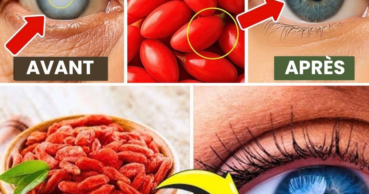 Mangez ces 9 fruits chaque jour pour améliorer votre vision et prévenir naturellement la cataracte