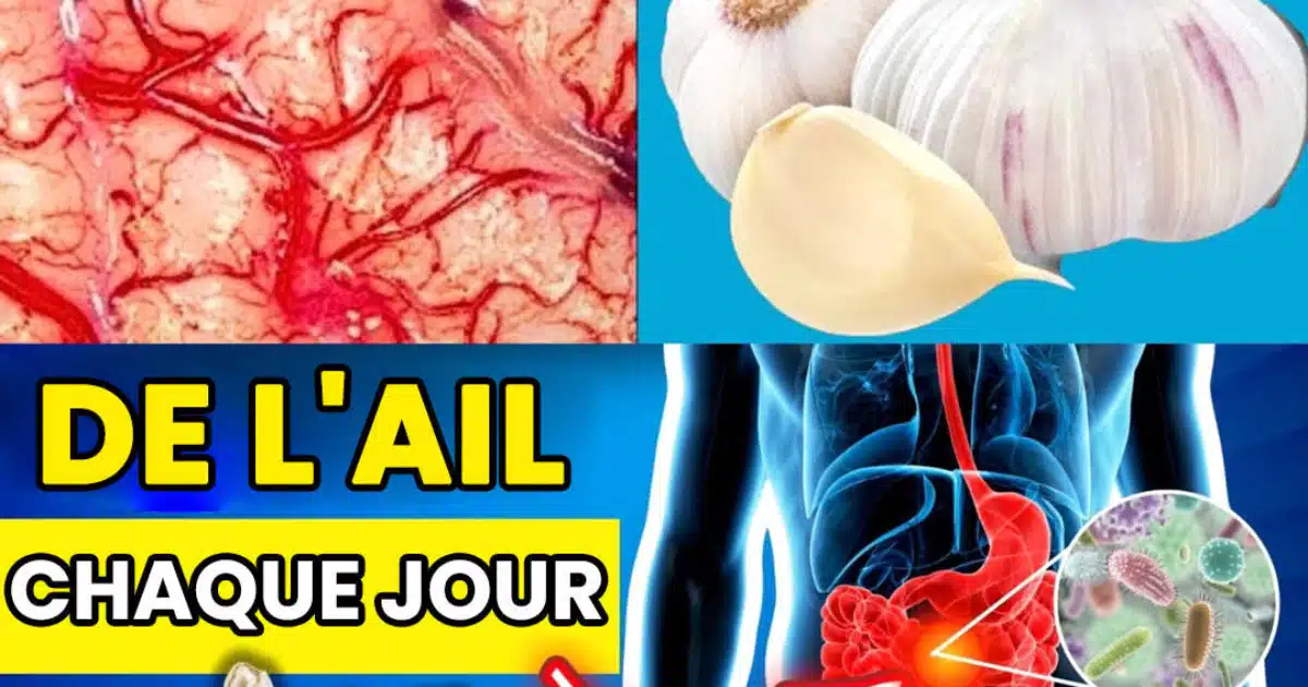 Mangez de l'ail avant de dormir et soyez étonné par ce qui se passe