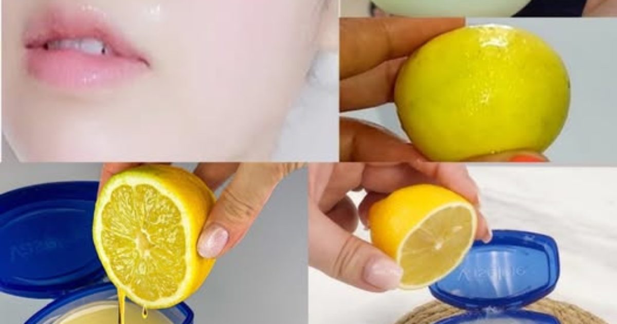 Mélangez de la vaseline et du citron : un remède maison pour la peau