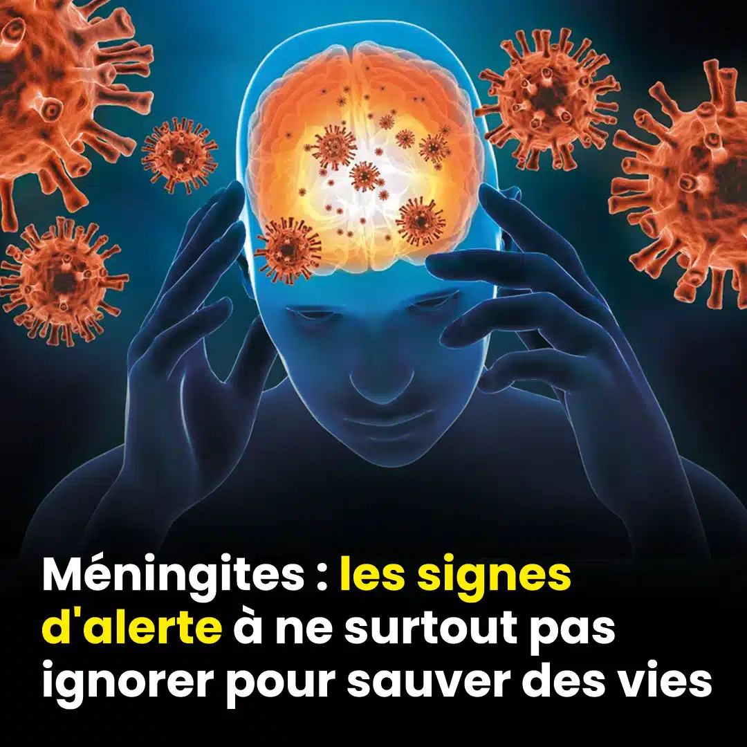 Méningite : ces signes d'alerte cruciaux à ne pas ignorer pour sauver des vies