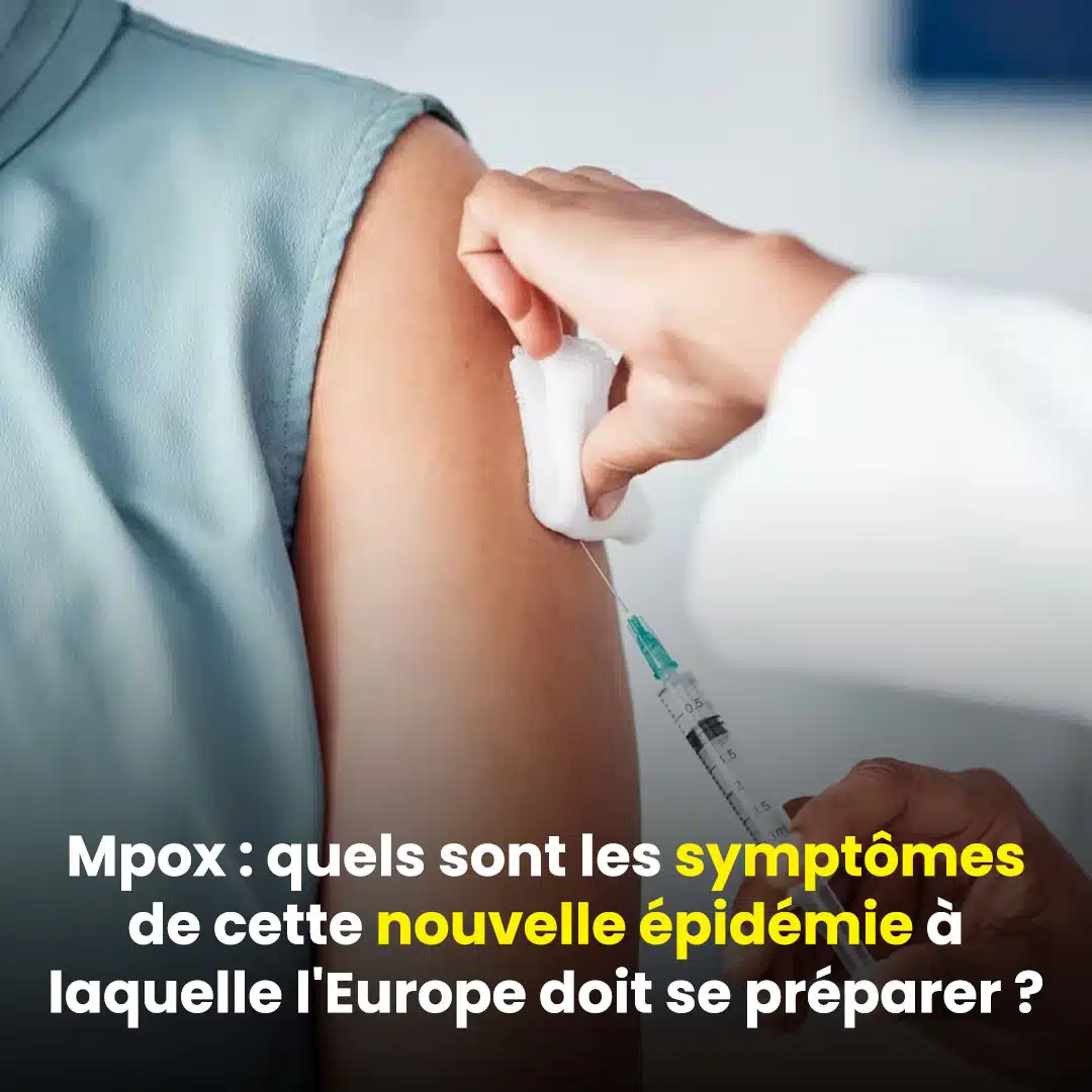 Mpox : Quels symptômes caractérisent cette épidémie que l'Europe doit se préparer ?