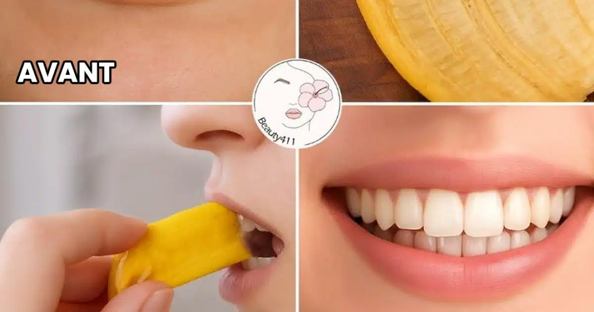 Ne jetez pas les peaux de banane : elles sont un trésor pour la santé