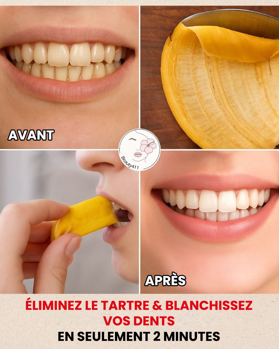 Ne jetez pas les peaux de banane : elles sont un trésor pour la santé