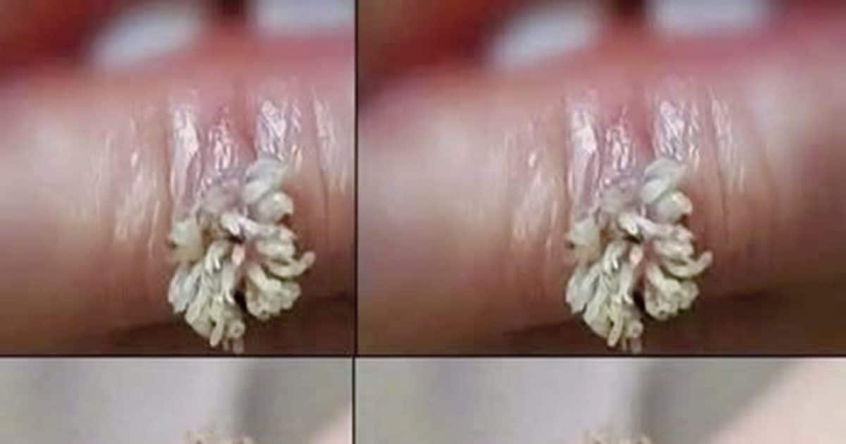 Ne l’ignorez pas : ce petit détail sur votre peau a une explication