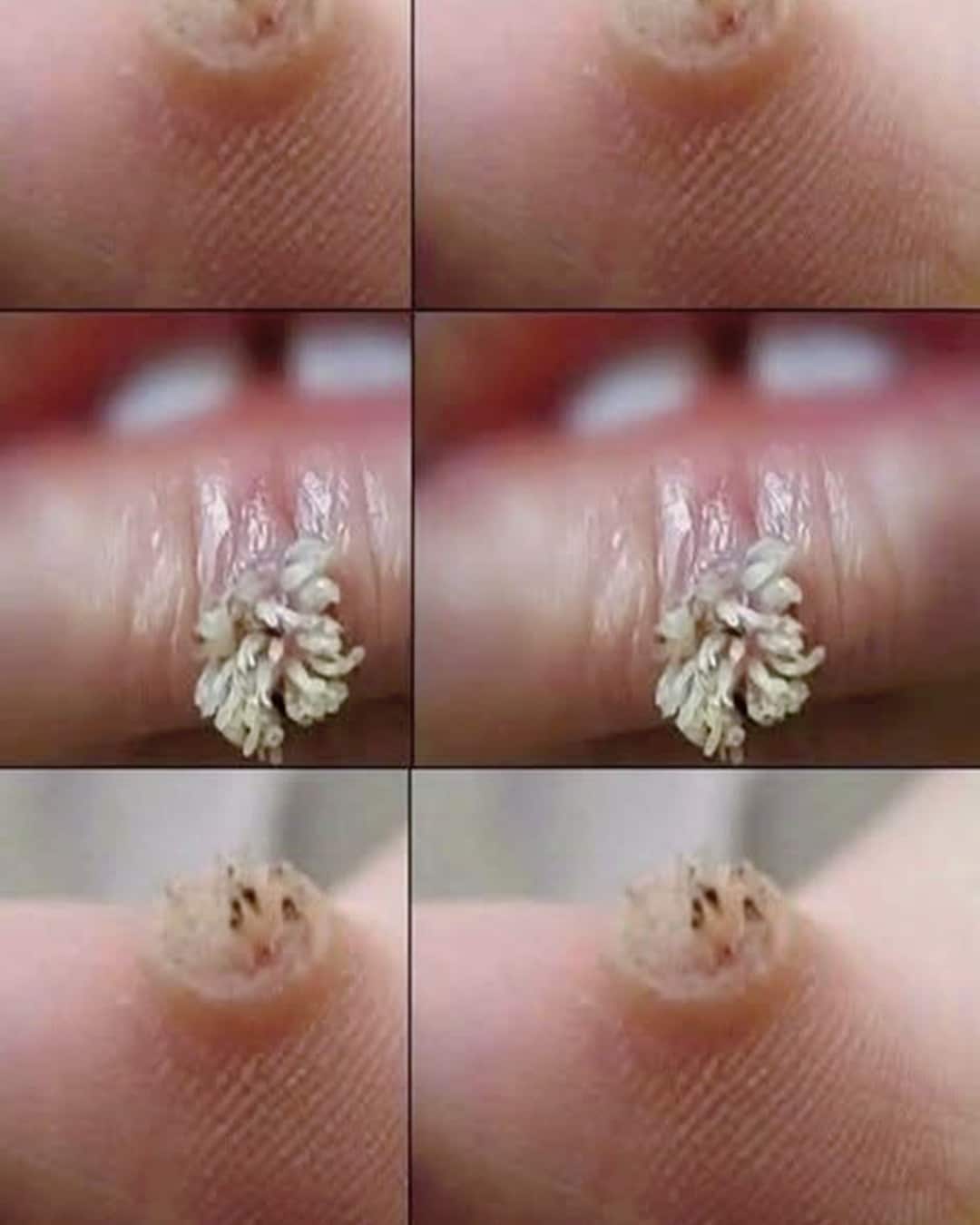Ne l’ignorez pas : ce petit détail sur votre peau a une explication