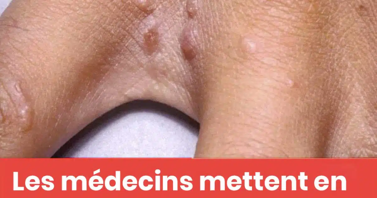 Ne négligez pas ces petites taches rouges sur votre bras – Elles pourraient être des signes d’alerte importants.