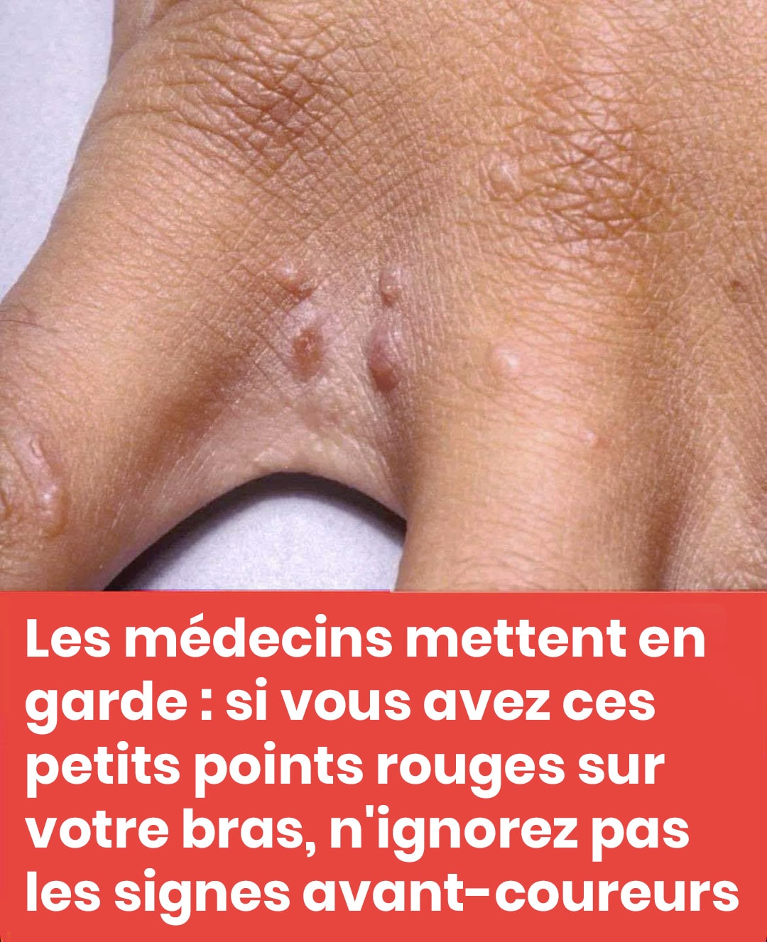 Ne négligez pas ces petites taches rouges sur votre bras – Elles pourraient être des signes d’alerte importants.