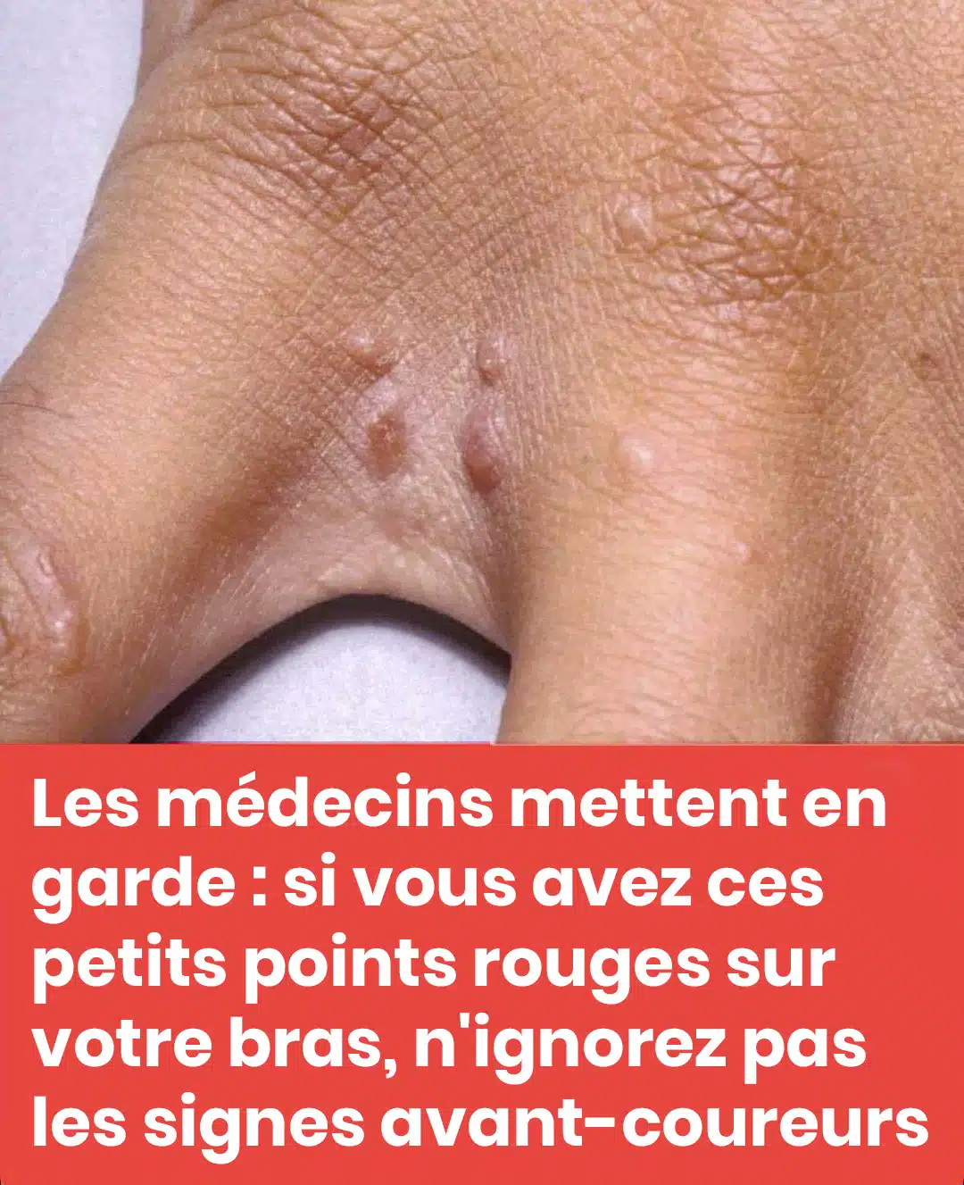 Ne négligez pas ces petites taches rouges sur votre bras – Elles pourraient être des signes d’alerte importants.
