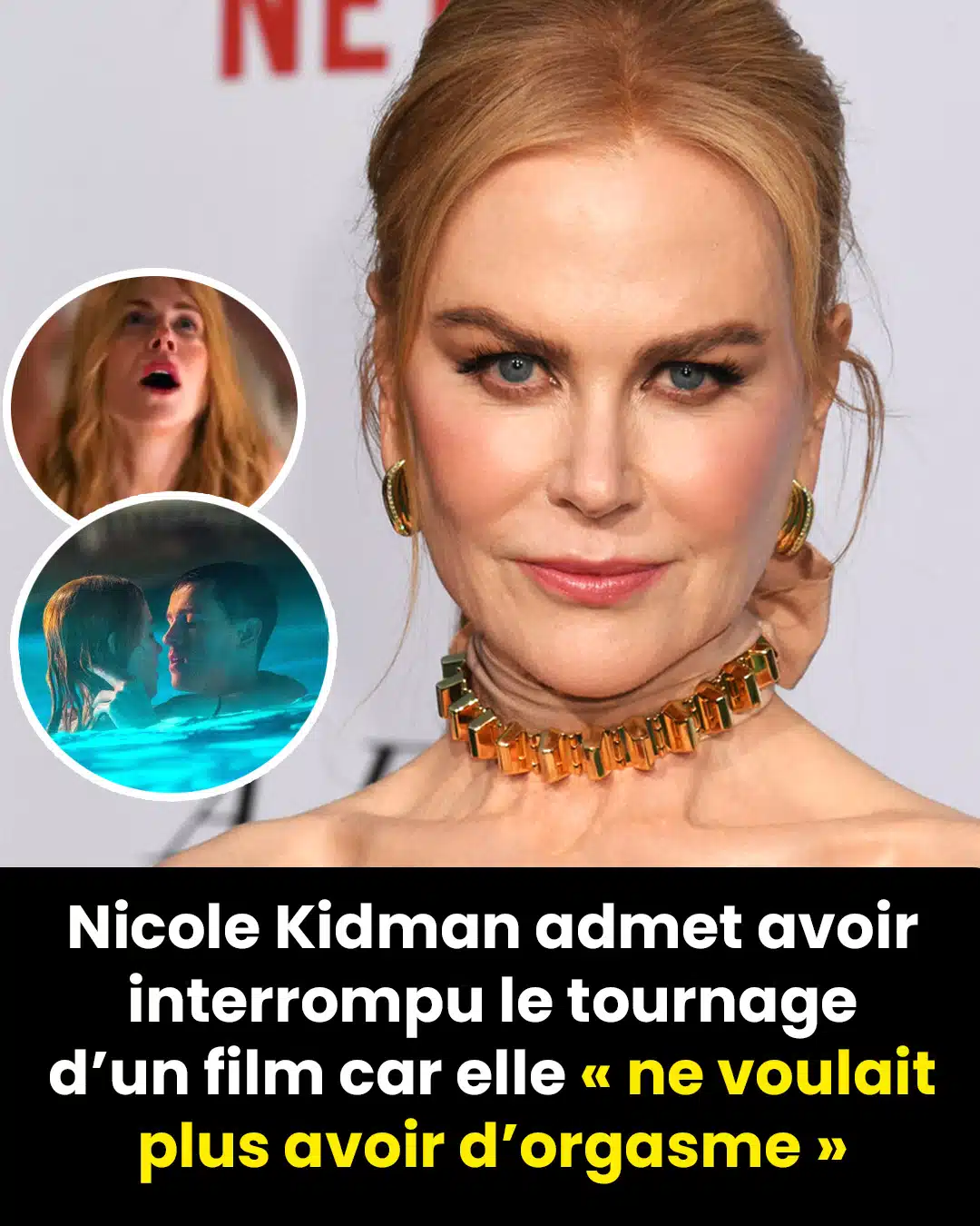Nicole Kidman contrainte d’arrêter le tournage de son nouveau film