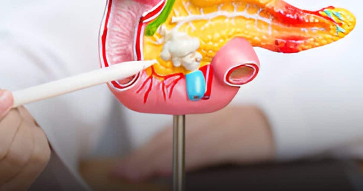 Pancréas : le tout premier signe qui doit vous alerter selon un médecin