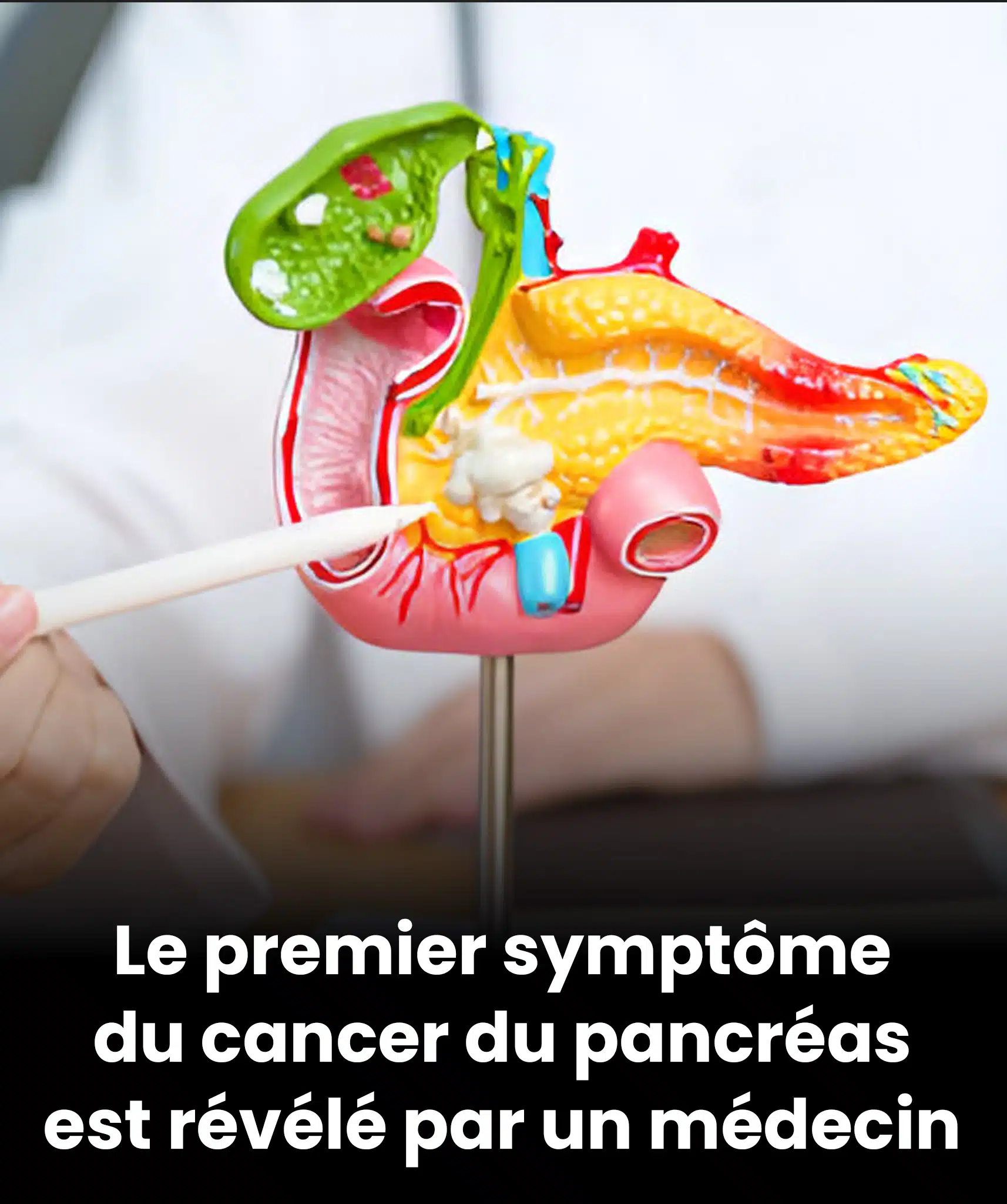 Pancréas : le tout premier signe qui doit vous alerter selon un médecin