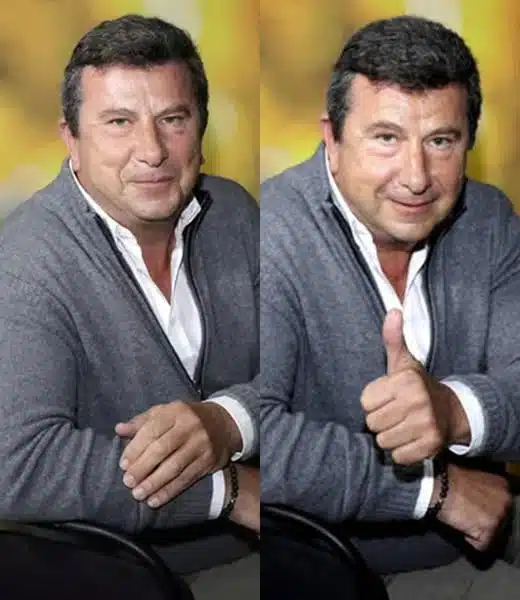 Pascal Bataille, touché par un cancer, parle de sa chute de cheveux : « Je ne souhaite pas porter de perruque »