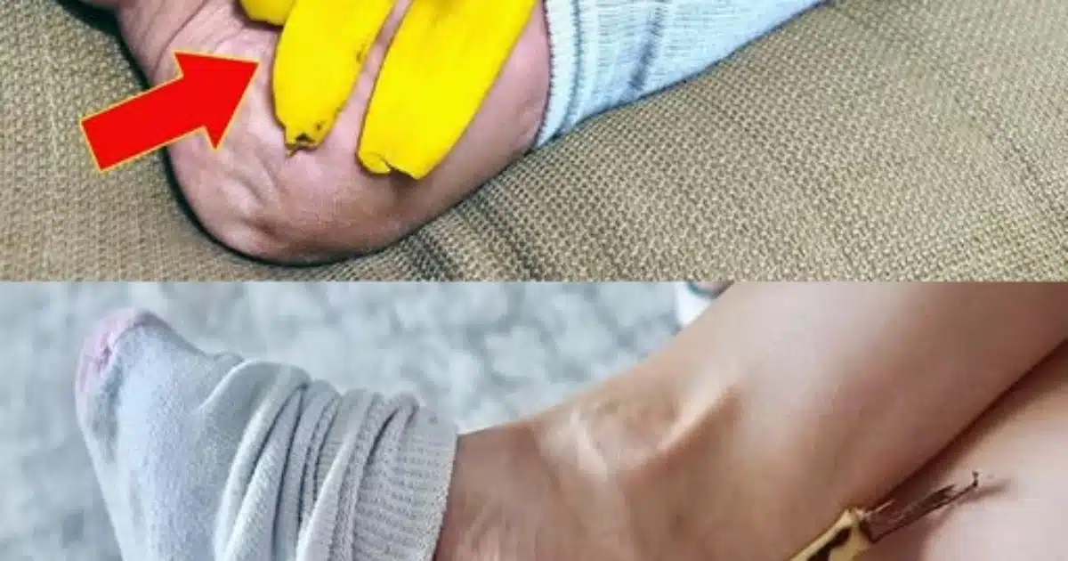 Peau de banane sur vos pieds : un remède naturel surprenant