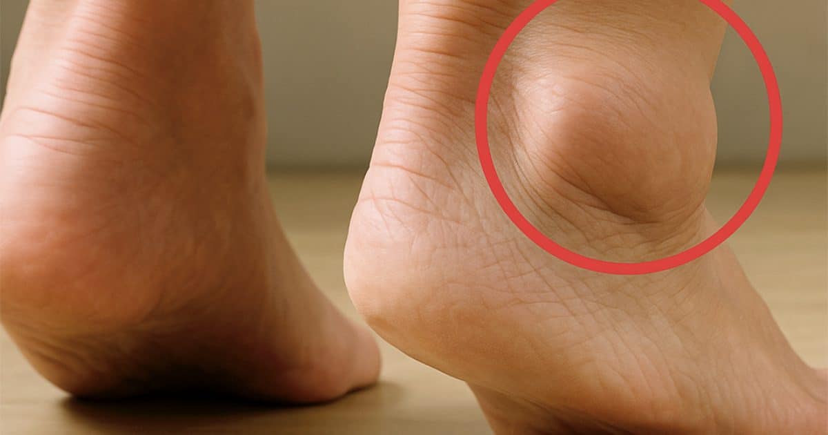 Pieds qui gonflent : quelles significations et quelles solutions ?