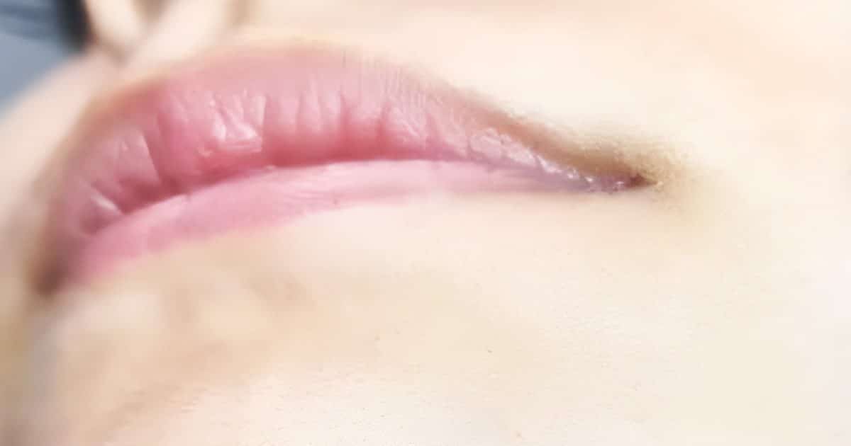 Poils au menton chez une femme : quelles significations ?