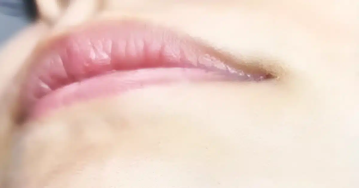 Poils au menton chez une femme : quelles significations ?