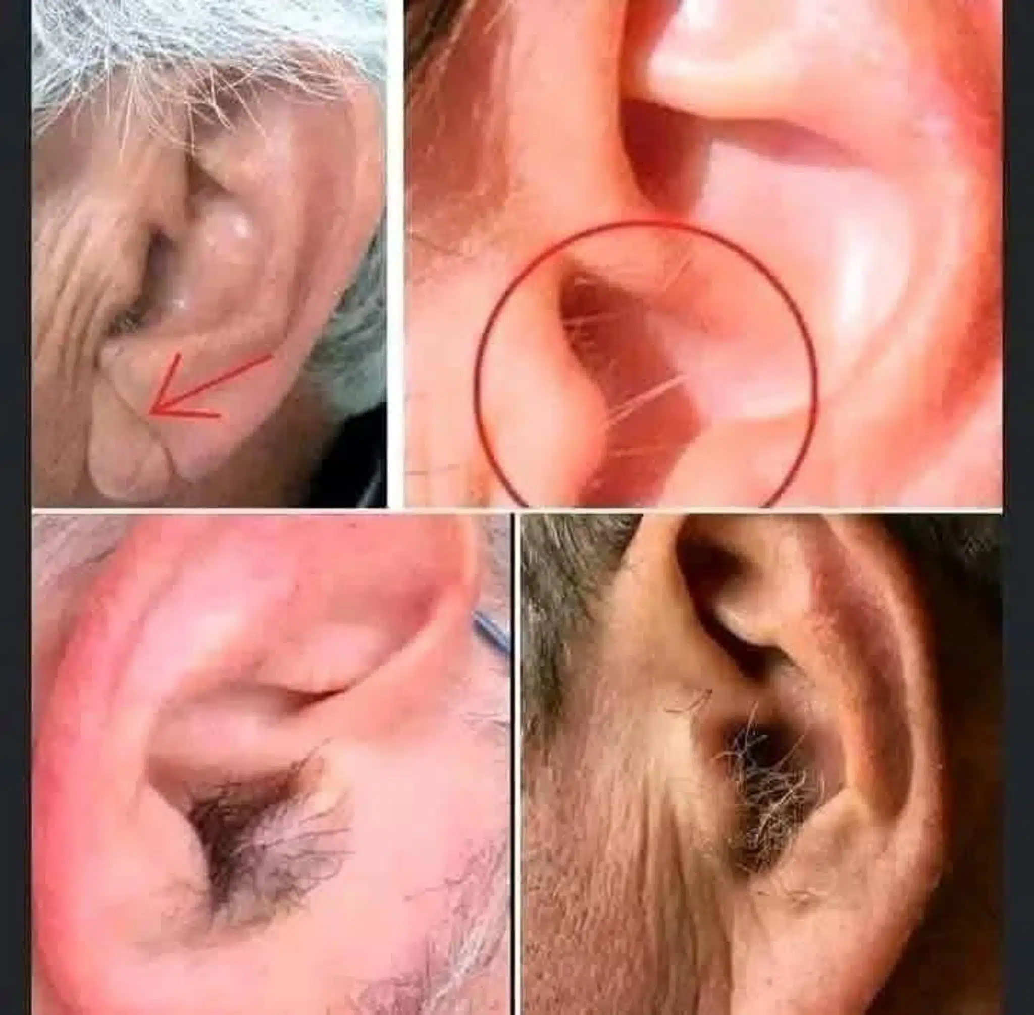 Poils qui poussent dans les oreilles : quelles significations ?