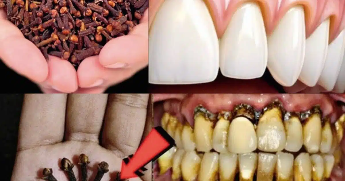 Pourquoi est-il bon de mâcher des clous de girofle ?