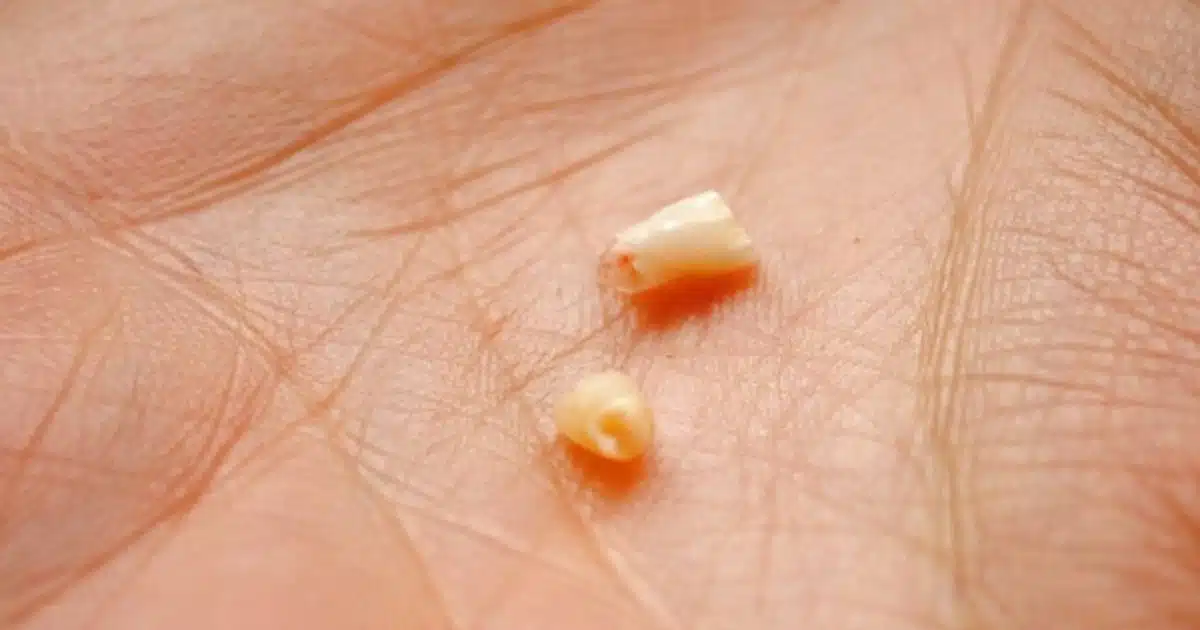 Pourquoi faut-il conserver les dents de lait de bébé ?