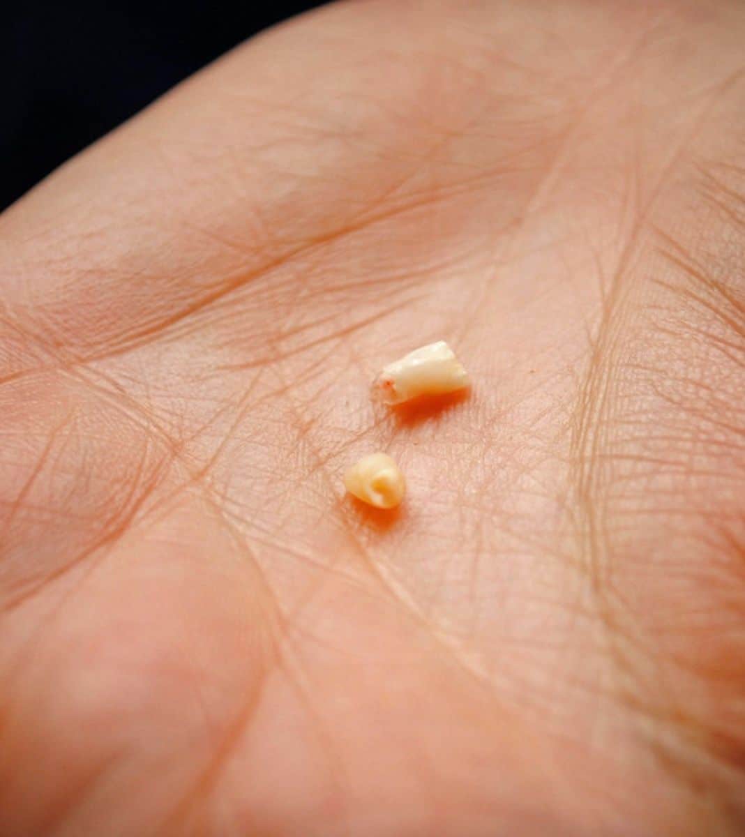 Pourquoi faut-il conserver les dents de lait de bébé ?
