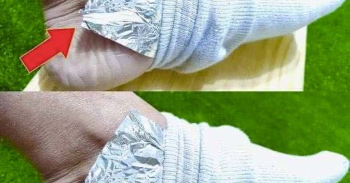Pourquoi faut-il envelopper ses pieds dans du papier aluminium ?