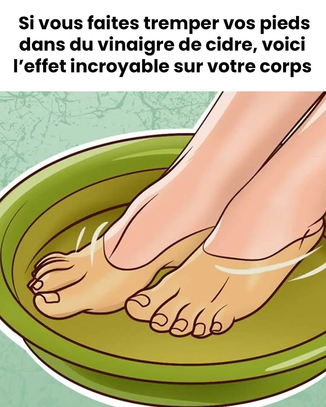 Pourquoi faut-il tremper ses pieds dans du vinaigre de cidre ?