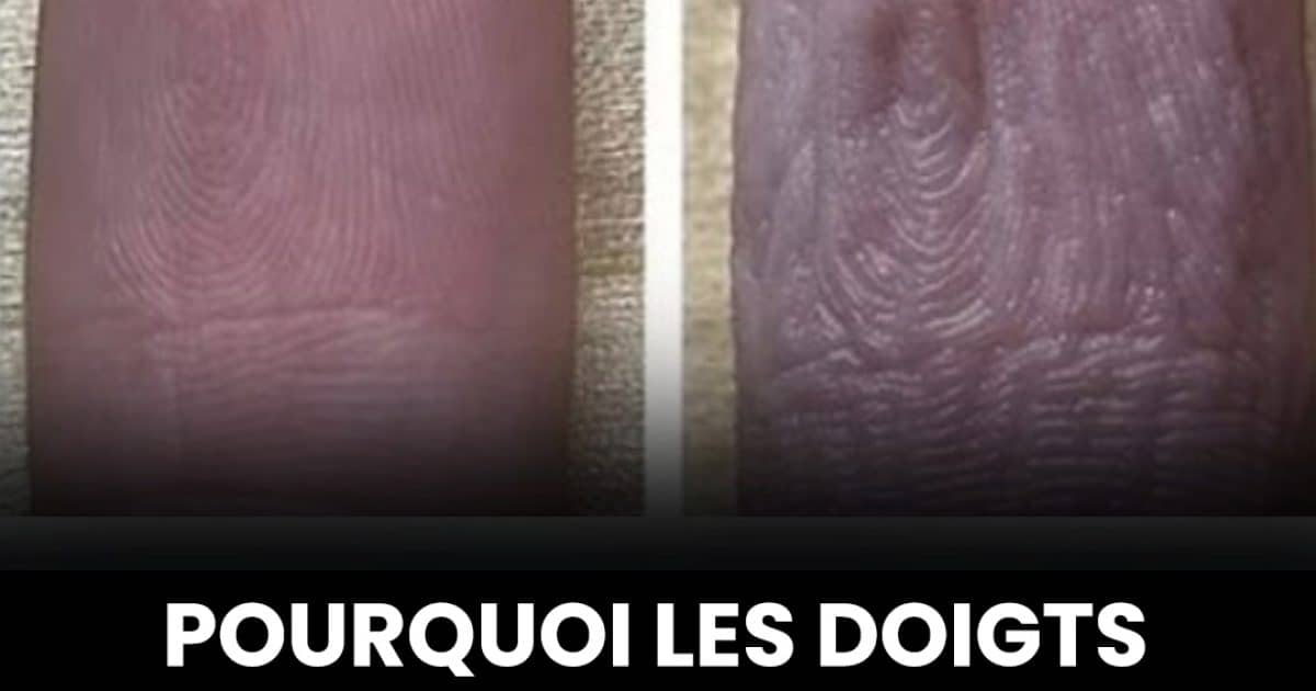 Pourquoi les doigts se rident-ils lorsqu’ils sont trempés dans l’eau ?