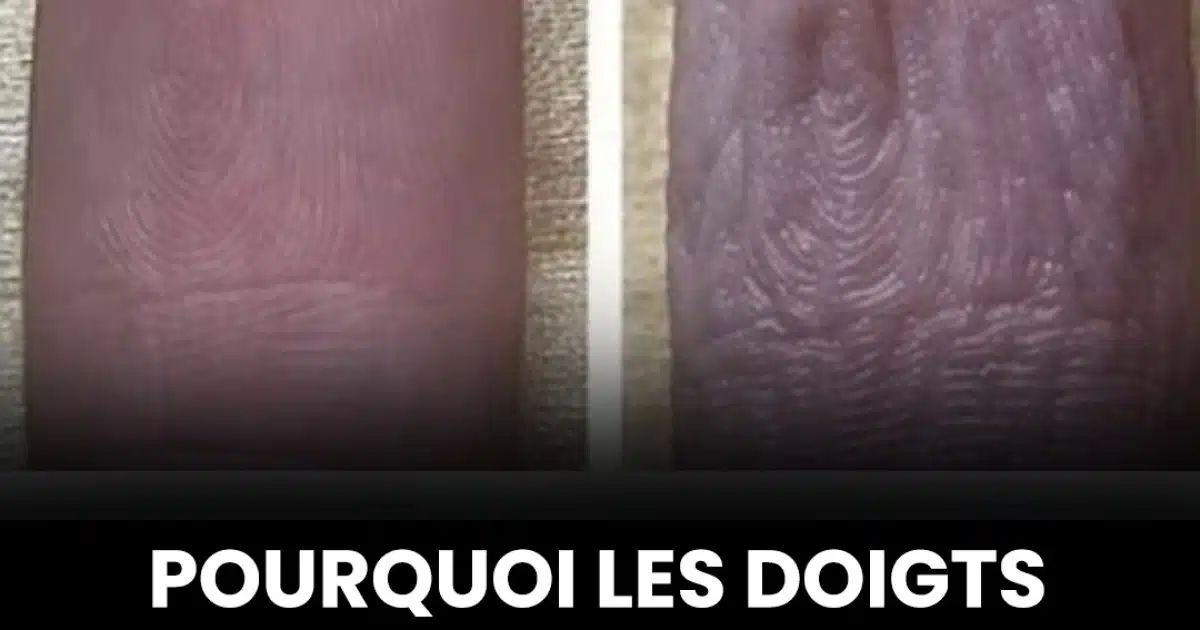 Pourquoi les doigts se rident-ils lorsqu’ils sont trempés dans l’eau ?
