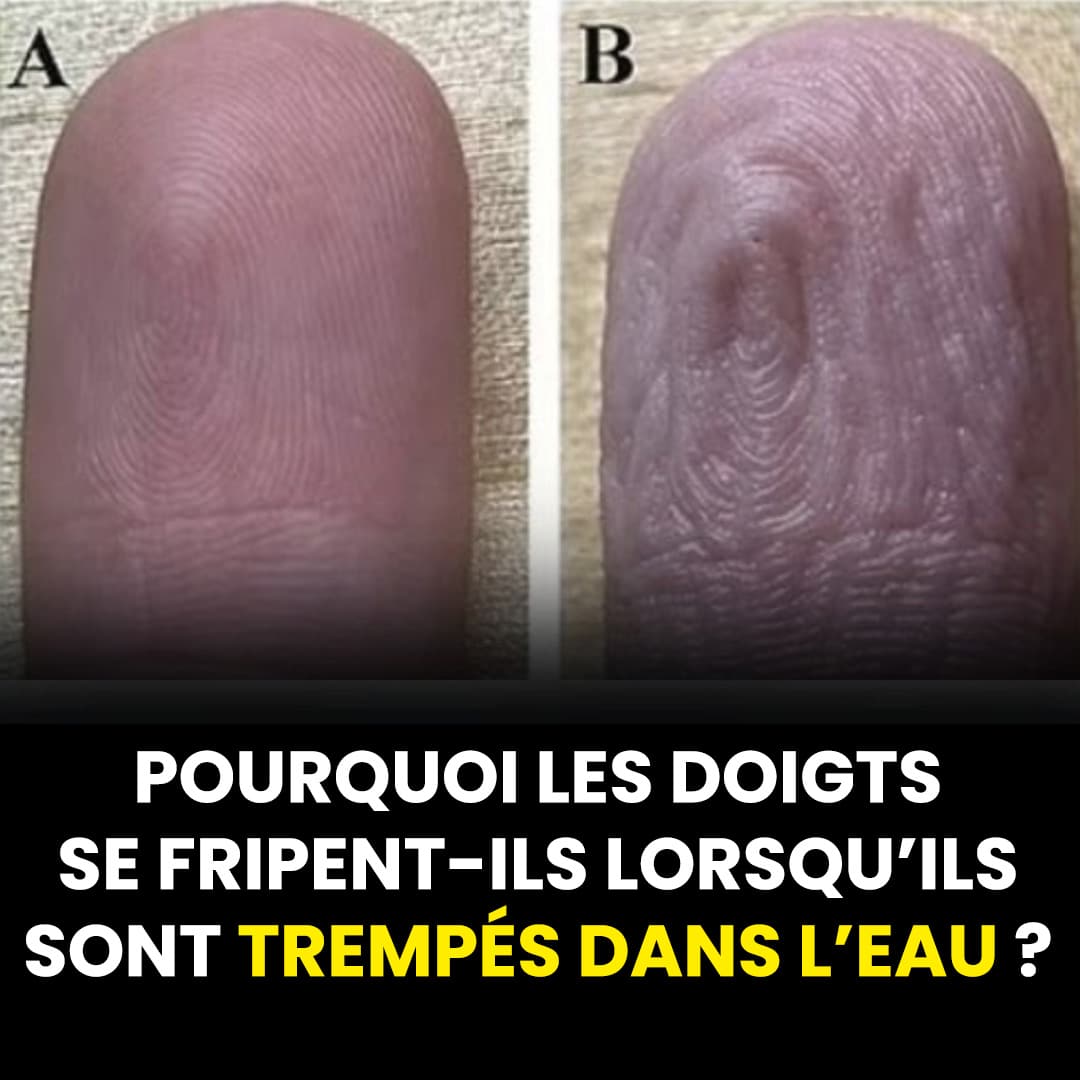 Pourquoi les doigts se rident-ils lorsqu’ils sont trempés dans l’eau ?