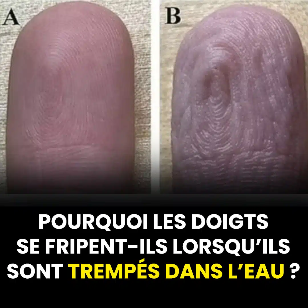 Pourquoi les doigts se rident-ils lorsqu’ils sont trempés dans l’eau ?