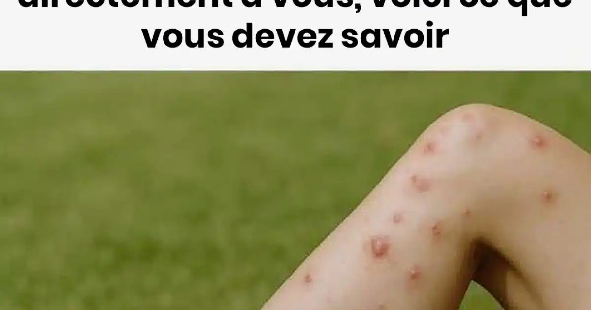 Pourquoi les moustiques sont plus attirés par vous que par les autres