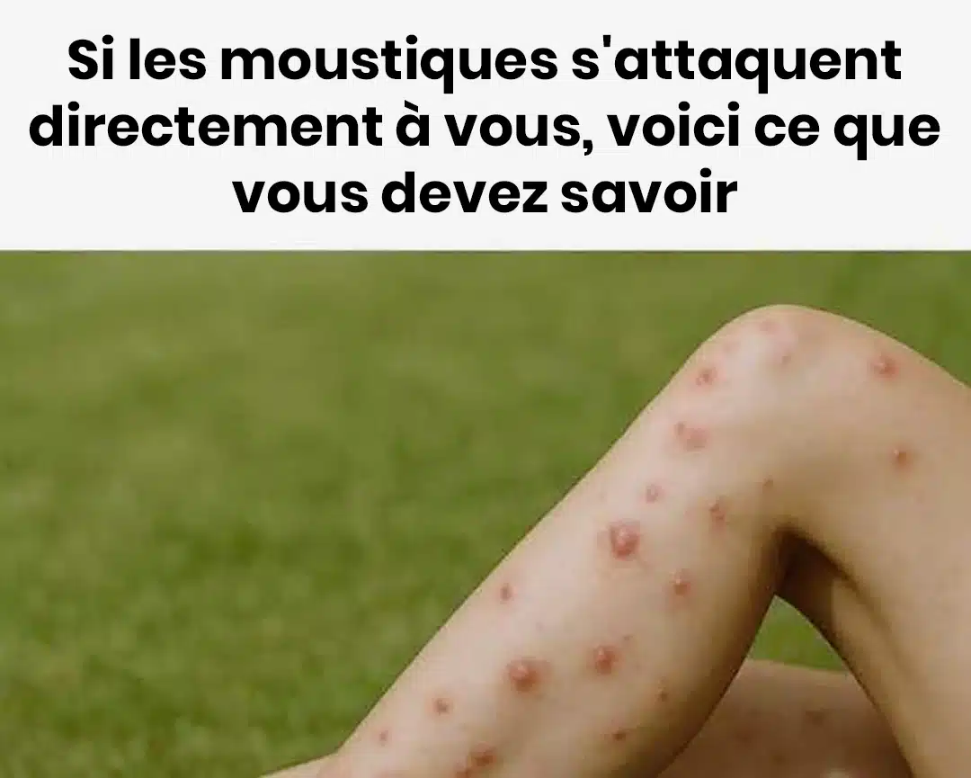 Pourquoi les moustiques sont plus attirés par vous que par les autres