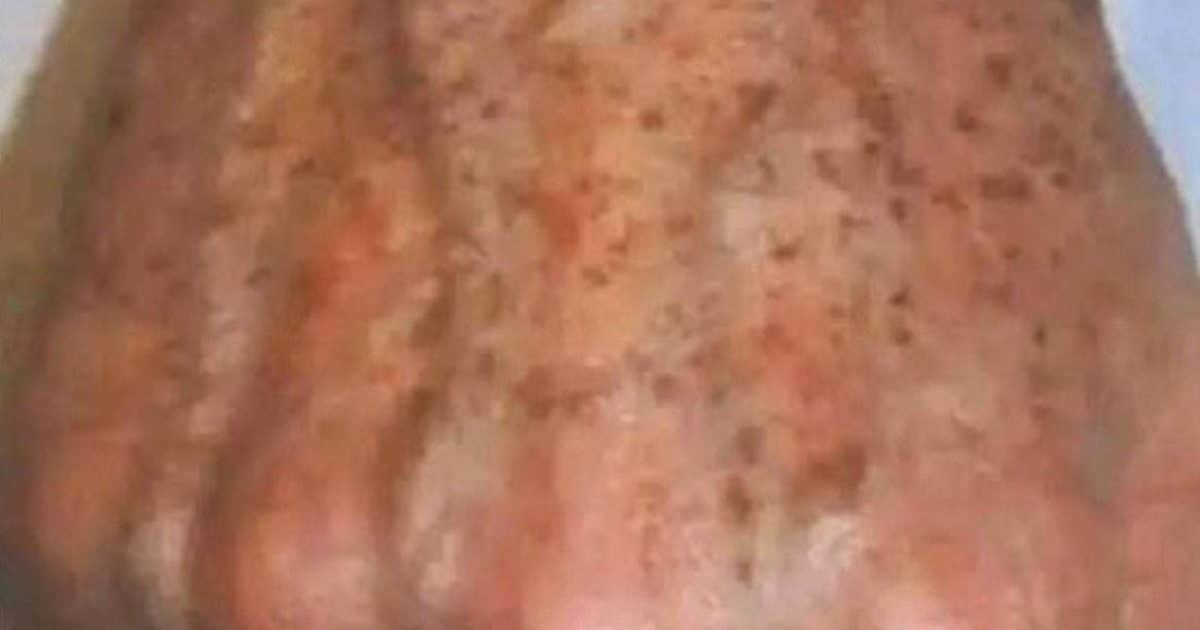 Pourquoi les taches apparaissent sur les mains et comment les éliminer ?