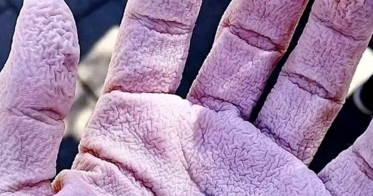 Pourquoi vos mains se froissent-elles dans l'eau ?