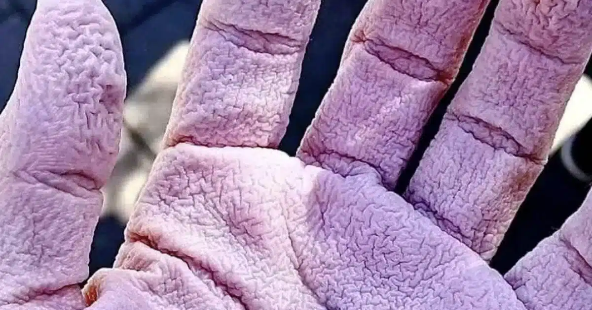 Pourquoi vos mains se froissent-elles dans l'eau ?