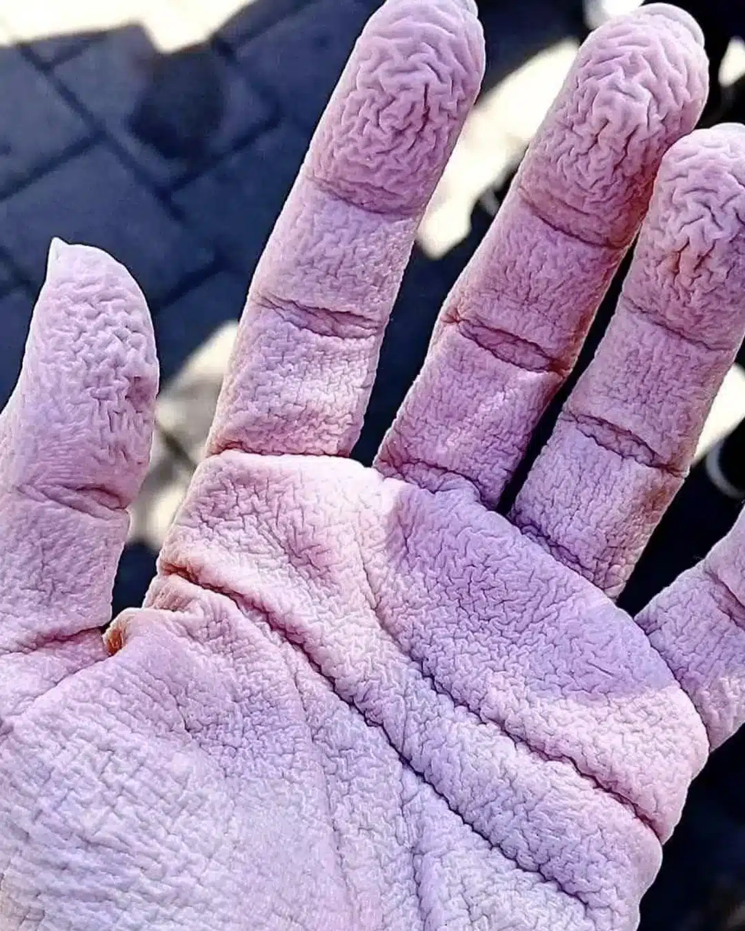 Pourquoi vos mains se froissent-elles dans l'eau ?
