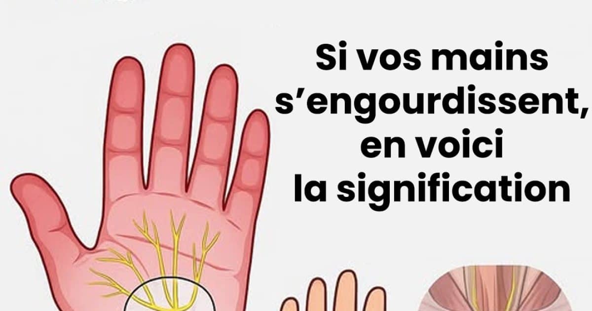 Pourquoi vos mains s'engourdissent-elles ?