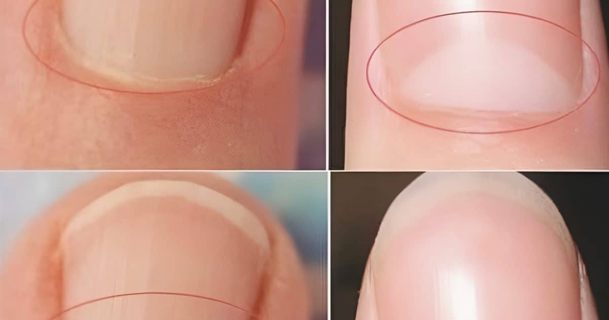 Que signifie la demi-lune à la base des ongles ?