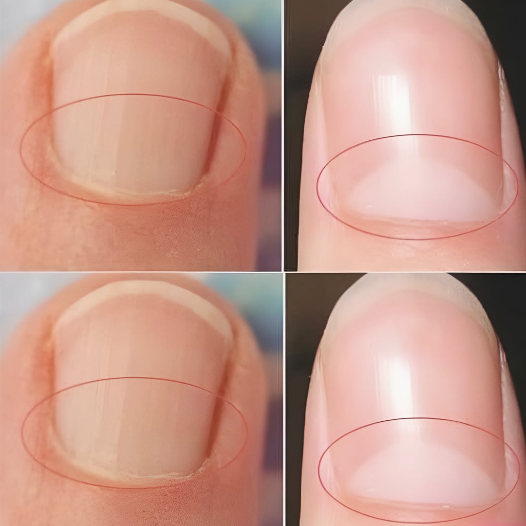 Que signifie la demi-lune à la base des ongles ?