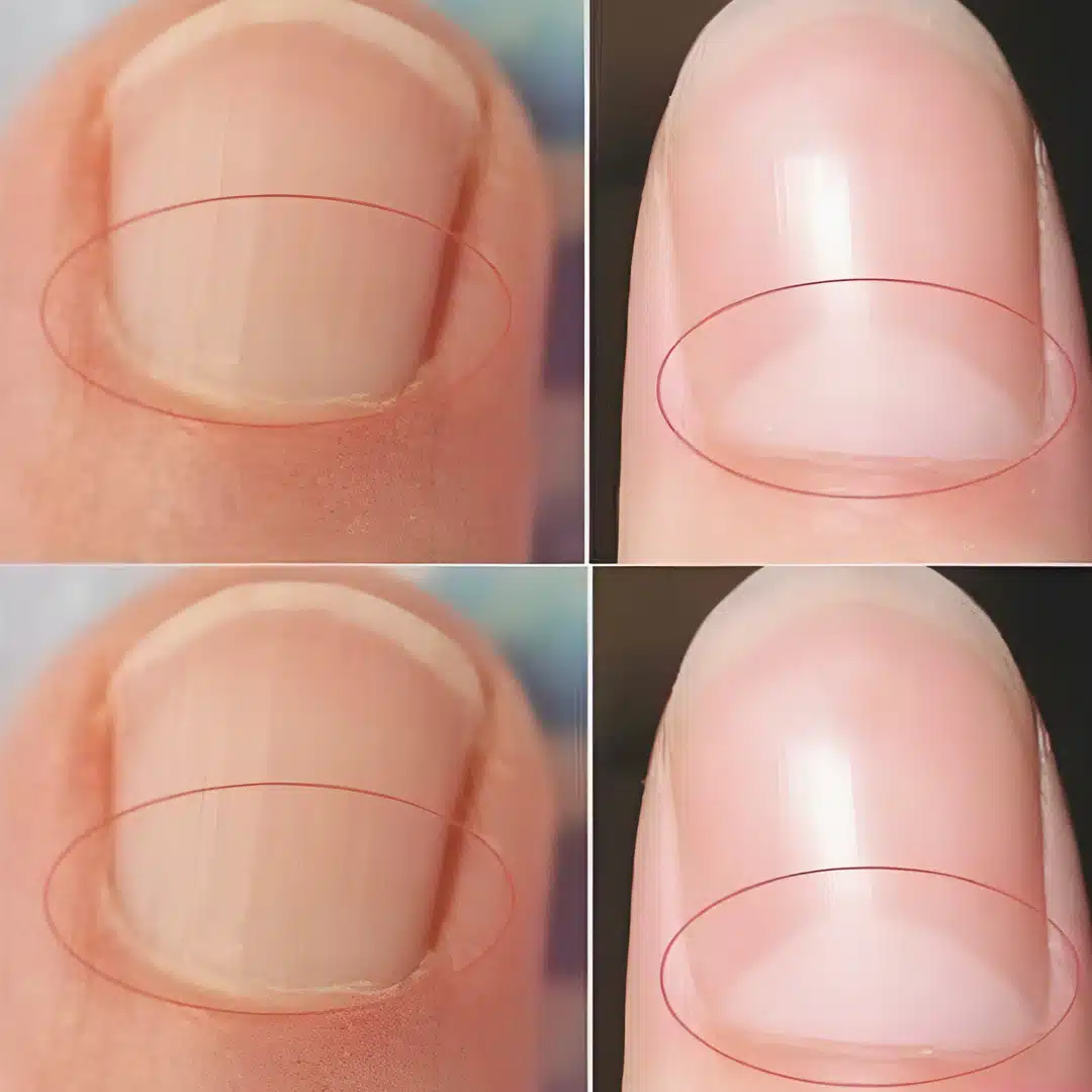 Que signifie la demi-lune à la base des ongles ?