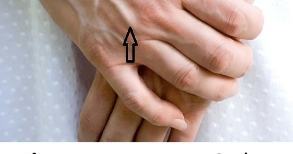 Que signifie les veines apparentes ?