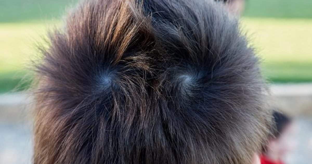 Que signifient des cheveux à double couronne sur la tête d’une personne ?