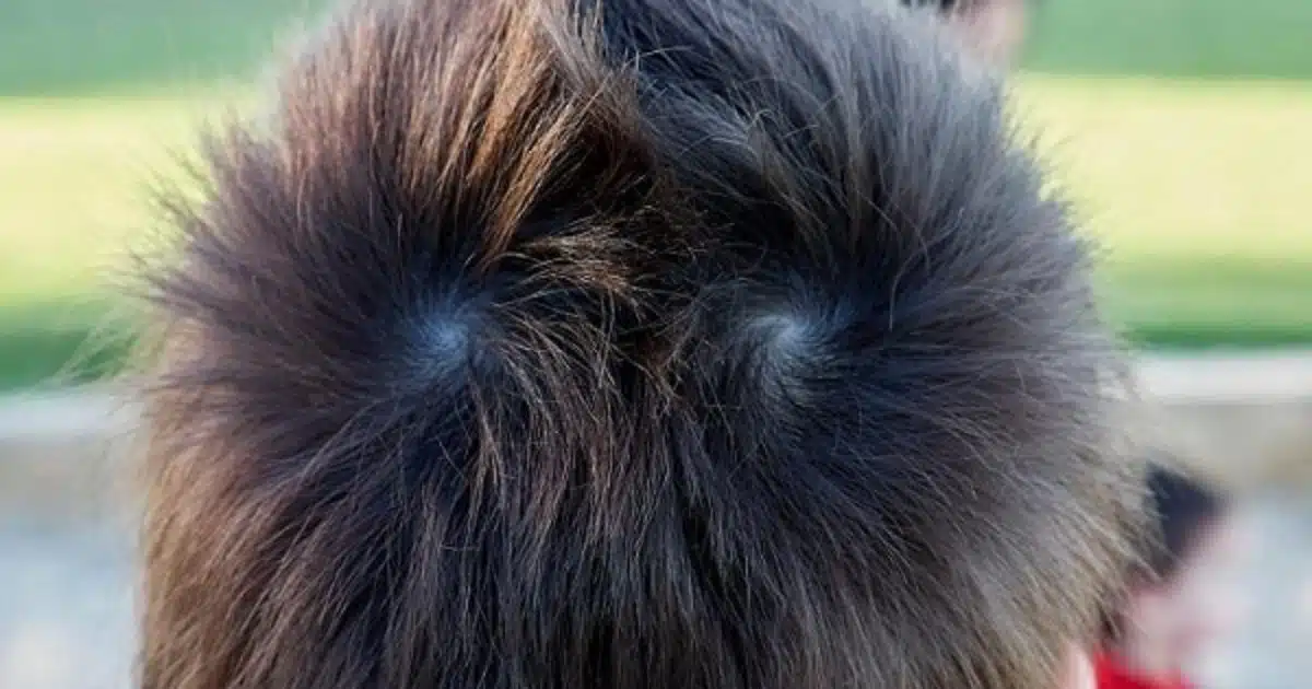 Que signifient des cheveux à double couronne sur la tête d’une personne ?