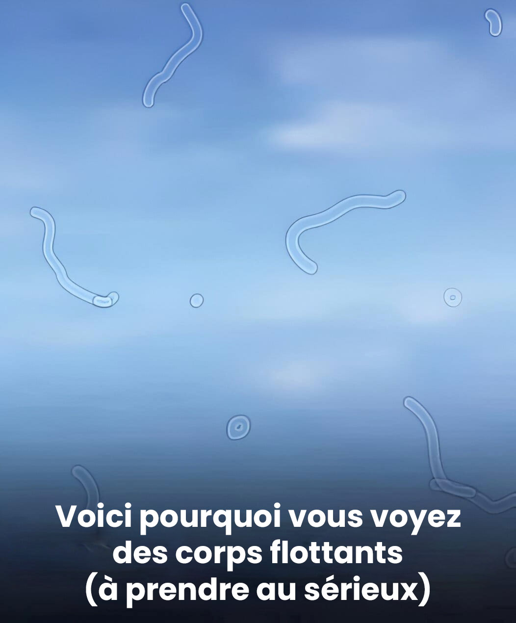 Que sont les corps flottants dans les yeux ? Voici ce qu’il faut faire si vous commencez à les remarquer